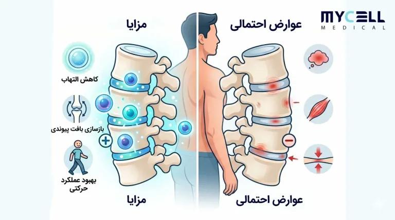 درمان دیسک کمر با سلول بنیادی؛ واقعیت علمی یا تبلیغات پزشکی؟