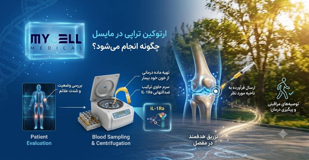 ارتوکین تراپی در مشهد