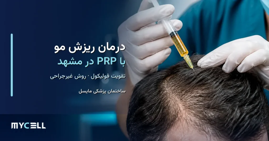 درمان ریزش مو با PRP در مشهد