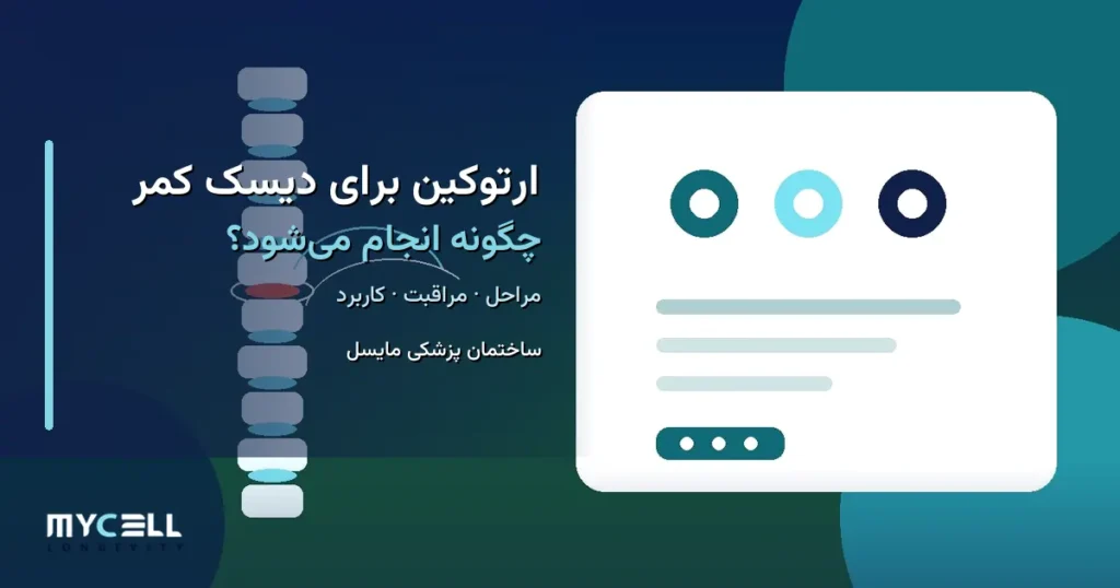 ارتوکین برای دیسک کمر چگونه انجام می‌شود؟